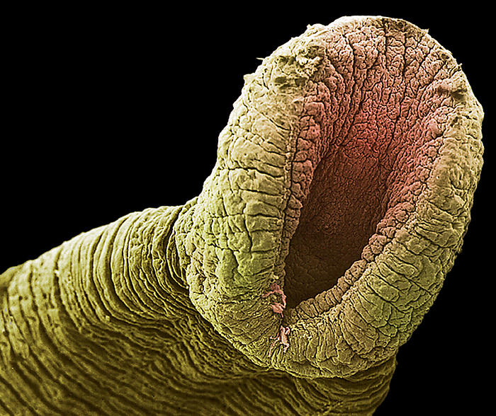 Freshwater leech s rear sucker, SEM Freshwater leech s rear sucker. Coloured scanning electron micrograph  SEM  of the rear sucker of a freshwater leech  family Hirudinidae . This parasite has two suckers, one at each end of its body, that it uses to attach itself to the skin of its victim whilst it drinks their blood. The mouth is contained within the head sucker. Freshwater leeches are found in lakes and marshes, as well as slow flowing streams. They feed on the blood of fish, amphibians and mammals.