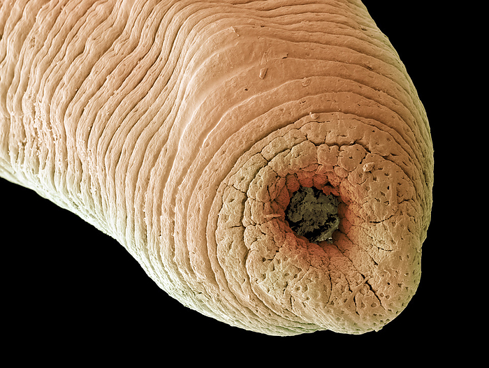 Freshwater leech s head sucker, SEM Freshwater leech s head sucker. Coloured scanning electron micrograph  SEM  of the head sucker of a freshwater leech  Hirudo sp. . This parasite has two suckers. Its rear sucker is used to attach itself to the victim while its head sucker contains a mouth and teeth, which are used to feed on the blood. Freshwater leeches are found in lakes and marshes, as well as slow flowing streams. They feed on the blood of fish, amphibians and mammals. Magnification: x100 when printed 10 centimetres wide.