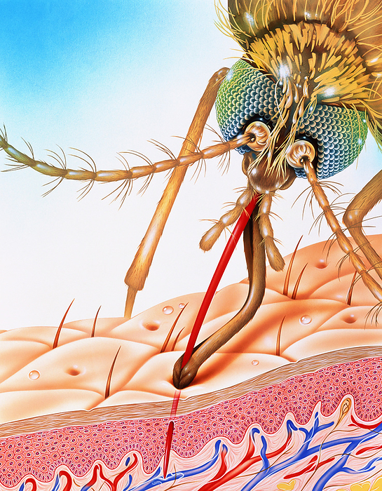 Mosquito feeding Malaria mosquito. Illustration showing a mosquito on human skin, sucking blood. It has inserted its modified proboscis  red  into a superficial blood vessel. Mosquitoes transmit diseases such as malaria, viral encephalitis, yellow fever, and filariasis. Malaria is a major health problem in Africa, Asia, India   South America. Malaria causes a severe fever   can lead to sometimes fatal complications affecting the liver, brain   blood. Preventative measures against mosquitoes are important, as the malaria parasites are developing resistance to anti malarial drugs. Measures include using mosquito nets, protective clothing, insecticides   release of sterile males.