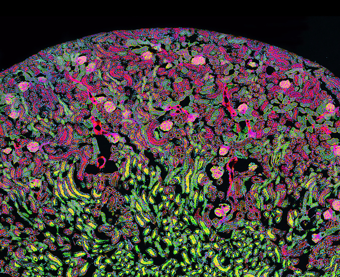 Kidney, confocal light micrograph Confocal light micrograph of a section through a kidney showing glomeruli  pink and yellow  surrounded by supporting tissue. The function of the glomeruli is to filter waste products from the blood. After the reabsorption of certain substances elsewhere in the kidney, the liquid is transported to the bladder as urine. Magnification: x200 when printed at 10 centimetres wide., Photo by THOMAS DEERINCK, NCMIR SCIENCE PHOTO LIBRARY