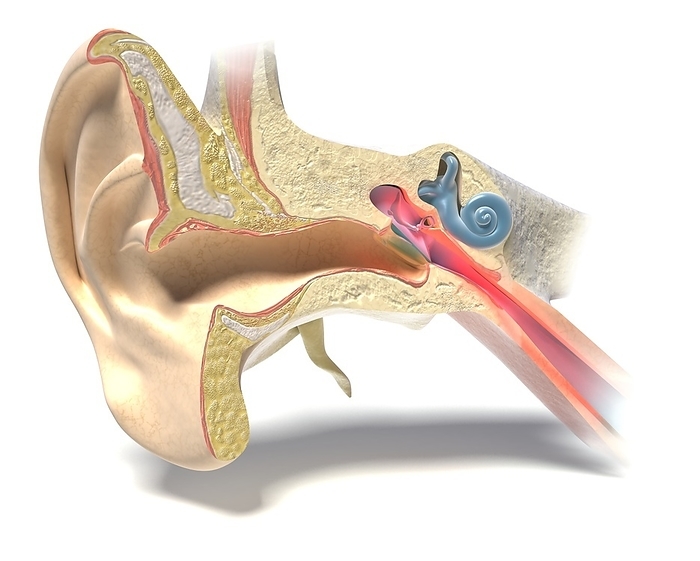 Middle ear infection, illustration Illustration showing a middle ear infection  otitis media . This condition causes inflammation of the middle ear area and fluid to fill the middle ear., Photo by MEDICAL GRAPHICS MICHAEL HOFFMANN SCIENCE PHOTO LIBRARY