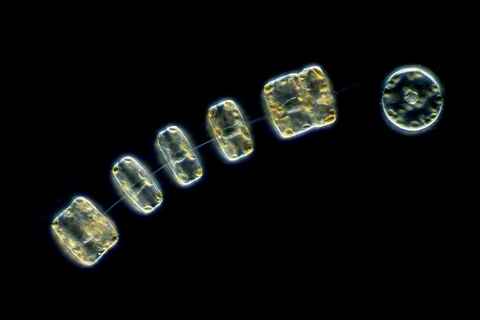 Thalassiosira marine diatoms, light micrograph Differential interference contrast  DIC  light micrograph of Thalassiosira rotula marine diatoms. Thalassiosira occurs as cells in chains linked by chitin threads. Diatoms are an important part of the phytoplankton in the cold oceans. Sample taken from the North Sea. Magnification: x380 when printed at 10 centimetres wide., Photo by FRANK FOX SCIENCE PHOTO LIBRARY