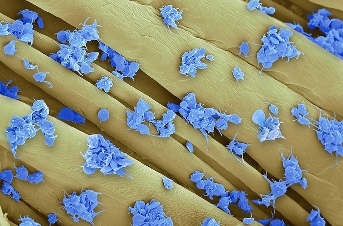 Activated platelets, SEM Activated platelets. Coloured scanning electron micrograph  SEM  of activated platelets  blue  attached to surgical gauze. Platelets are tiny blood cells that help the body form clots to stop bleeding. If a blood vessels gets damaged, it sends out signals that are picked up by platelets. The platelets then rush to the site of damage and form a plug, or clot, to repair the damage. The process of spreading across the surface of a damaged blood vessel to stop bleeding is called adhesion. This is because when platelets get to the site of the injury, they grow sticky tentacles that help them adhere. They also send out chemical signals to attract more platelets to pile onto the clot in a process called aggregation. Magnification: x2000 at 10cm wide.