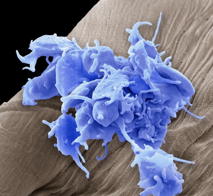 Activated platelets, SEM Activated platelets. Coloured scanning electron micrograph  SEM  of activated platelets  blue  attached to surgical gauze. Platelets are tiny blood cells that help the body form clots to stop bleeding. If a blood vessels gets damaged, it sends out signals that are picked up by platelets. The platelets then rush to the site of damage and form a plug, or clot, to repair the damage. The process of spreading across the surface of a damaged blood vessel to stop bleeding is called adhesion. This is because when platelets get to the site of the injury, they grow sticky tentacles that help them adhere. They also send out chemical signals to attract more platelets to pile onto the clot in a process called aggregation. Magnification: x7000 at 10cm wide.