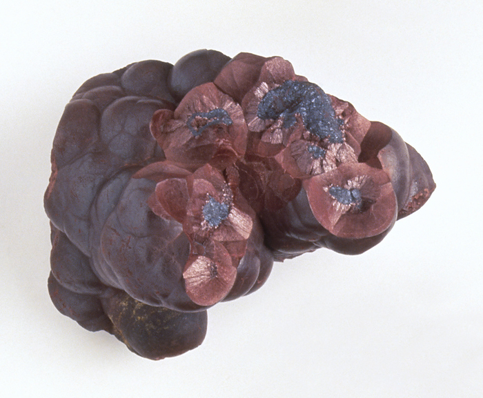 Kidney ore Kidney ore., Photo by DK IMAGES SCIENCE PHOTO LIBRARY
