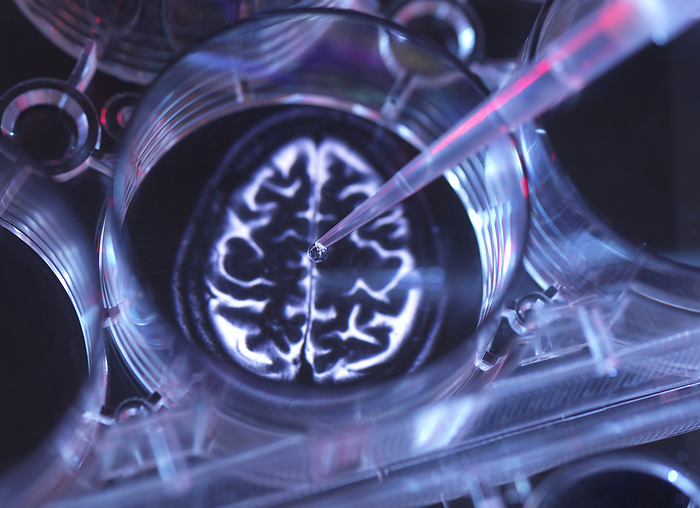 Pipetting a cure into a multi well plate for alzheimers and dementia. Medical sample inside microplate with image of human brain, Photo by Andrew Brookes