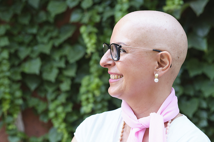 Barcelona, Spain   Woman with Cancer lifestyle Smiling bald woman looking away at backyard