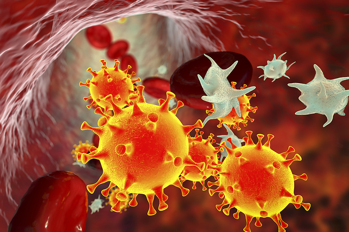 COVID 19 virus and activated platelets, illustration COVID 19 virus particles and activated platelets in blood stream participating in clot formation, conceptual illustration., by KATERYNA KON SCIENCE PHOTO LIBRARY