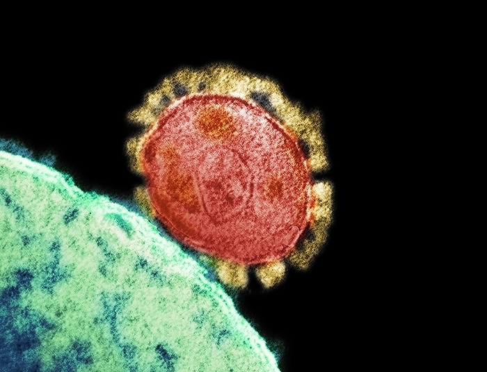 MERS coronavirus, TEM Coloured transmission electron micrograph  TEM  of a Middle East respiratory syndrome  MERS  coronavirus particle  red  budding from a host cell  green . This virus, which first emerged in Saudi Arabia in 2012, causes a severe acute respiratory illness with symptoms of fever, cough and shortness of breath., Photo by NIAID NATIONAL INSTITUTES OF HEALTH SCIENCE PHOTO LIBRARY