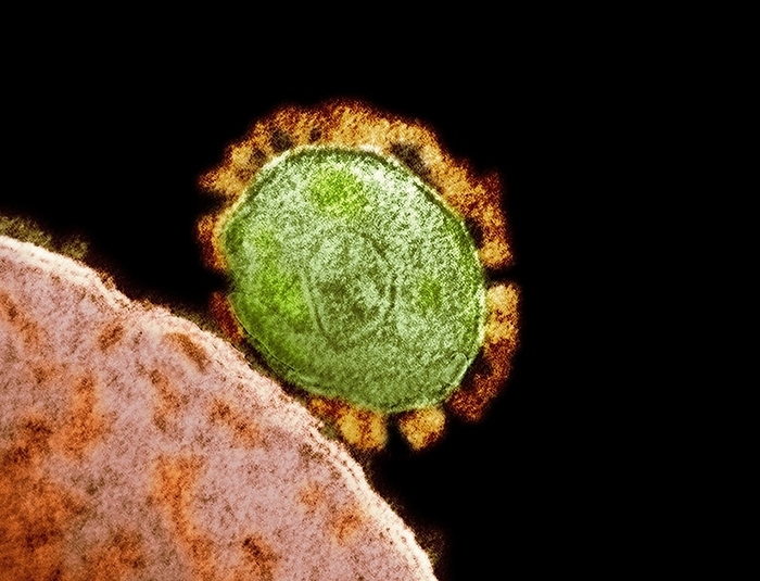 MERS coronavirus, TEM Coloured transmission electron micrograph  TEM  of a Middle East respiratory syndrome  MERS  coronavirus particle  green  budding from a host cell  red . This virus, which first emerged in Saudi Arabia in 2012, causes a severe acute respiratory illness with symptoms of fever, cough and shortness of breath., Photo by NIAID NATIONAL INSTITUTES OF HEALTH SCIENCE PHOTO LIBRARY