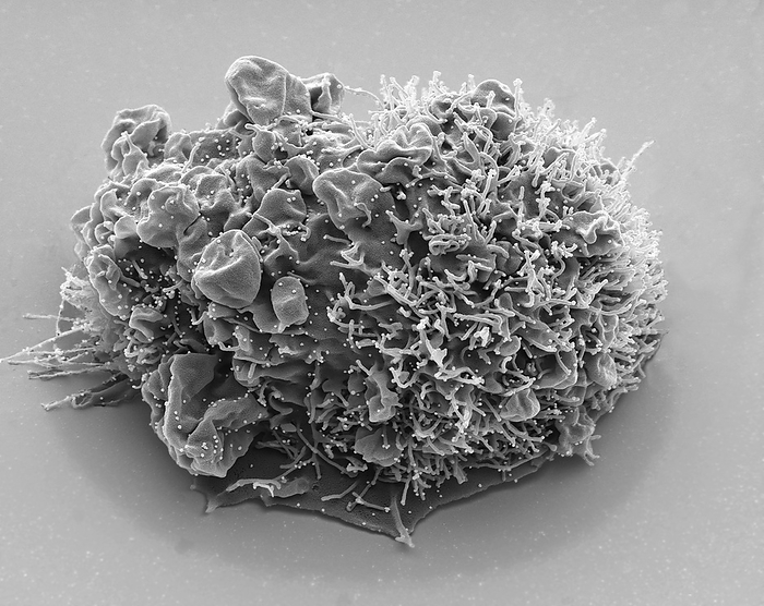 SARS CoV 2 Alpha variant, SEM SARS CoV 2 Alpha variant  B.1.1.7 lineage .Black and white electron micrograph  SEM . Here the alpha variant is shown budding  white dots  from a Vero mammalian kidney epithelial cell 24 hours after infection. The Alpha variant was first detected in September 2020 in the UK and quickly spread worldwide becoming a variant of concern  VOC , due to its higher transmissibility from human to human and enhanced clinical severity. Public health measures and travel restrictions were imposed globally during December 2020 to attempt and contain the spread of the Alpha variant. The Delta variant emerged from India in late 2020 and took over globally from the alpha variant later in 2021.The coronaviruses take their name from their crown  corona  of surface proteins, which are used to attach and penetrate their host cells. Magnification x 8000 at 10cm wide. Specimen courtesy of Greg Towers, UCL., Photo by STEVE GSCHMEISSNER SCIENCE PHOTO LIBRARY