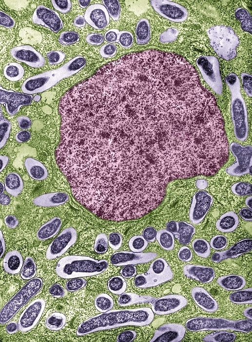 Nitrogen fixing bacteroids in a pea root Transmission electron micrograph of a sectioned nitrogen fixing nodule on a pea root, Pisum sativum, following infection by the bacterium Rhizobium leguminosarum. Infection starts when a bacterium in the soil contacts a root hair. The root responds by producing an infection thread, inviting the bacterium to enter the root. Once inside, the bacterium divides repeatedly, enclosed within a network of plant cell membranes  purple .The plant develops a tumour like growth on the root surface   a nodule. The bacteria lose their external wall, and differentiate to become pleiomorphic  bacteroids . Fed by the plant, the bacteroids are able to metabolise   fix   atmospheric nitrogen, to produce ammonium salts. This benefits the plant  the relationship is one of symbiosis. Here, the bacteroids are granular dark purple  the plant nucleus  10 microns wide  is red  and the cell cytoplasm is green., Photo by DR JEREMY BURGESS SCIENCE PHOTO LIBRARY