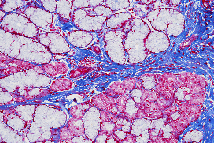 Sublingual salivary gland, light micrograph Light micrograph of a section of a human sublingual salivary gland. The two sublingual salivary glands are found below the tongue, and secrete mostly mucus, as well as some serous fluid and amylase enzyme into the mouth to aid mastication and begin the digestion of starch into sugar. They are divided into lobules each consisting of predominately mucus secreting units  acini   white  and a few serous secreting units  pink , both of which are continuous with secretory ducts. Connective tissue  blue  runs between the lobules carrying blood vessels, nerves and excretory ducts. Magnification: x200 when printed at 15cm wide., Photo by EYE OF SCIENCE SCIENCE PHOTO LIBRARY