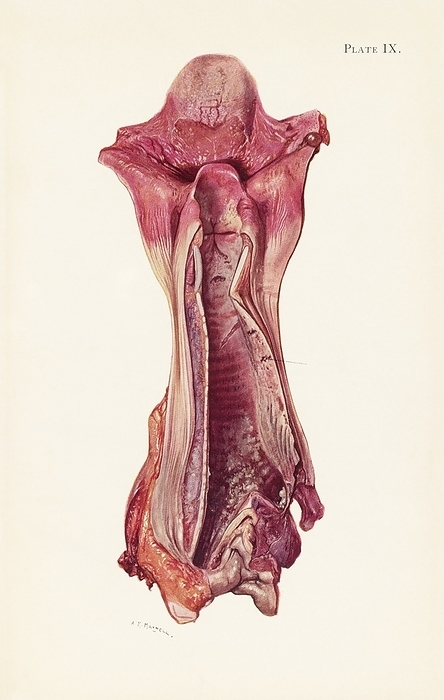 Ulceration of a trachea after mustard gas poisoning Illustration showing ulceration of a soldier s trachea on the twelfth day after being gassed with mustard gas during the First World War. At the top, the tongue and trachea are inflamed. Mustard gas was used as a chemical warfare agent in the First World War. Exposure to mustard gas can cause coughing and shortness of breath in the short term. It also has long term effects such as mouth, throat and skin cancer as well as leukaemia. The use of chemical weapons in the First World resulted in 90,000 deaths and more than 1.3 million casualties. Published in An Atlas of Gas Poisoning, 1918., Photo by Science History Institute SCIENCE PHOTO LIBRARY