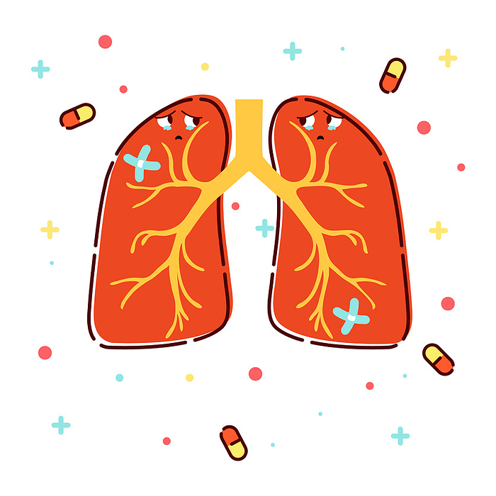 Lungs disorder, conceptual illustration Lungs disorder, conceptual illustration., by ART4STOCK SCIENCE PHOTO LIBRARY