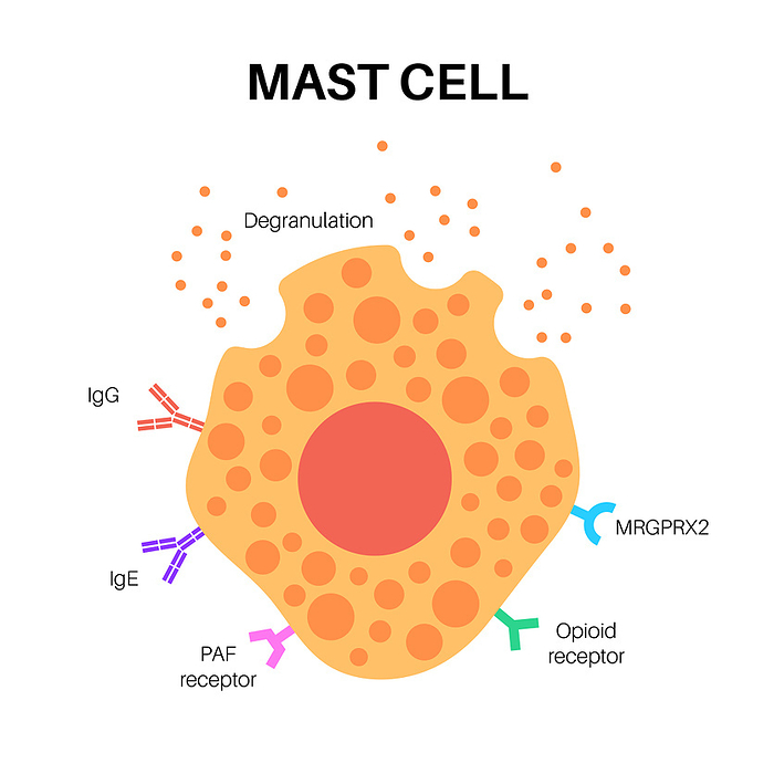 Mast cell, illustration Mast cell, illustration., by PIKOVIT   SCIENCE PHOTO LIBRARY