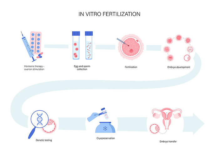 IVF, illustration IVF, illustration., by PIKOVIT   SCIENCE PHOTO LIBRARY