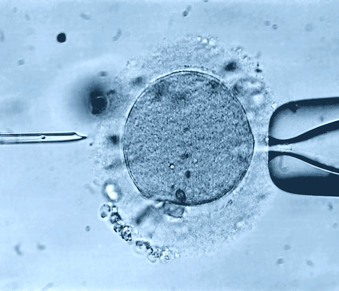 In vitro fertilisation, light micrograph In vitro fertilisation. Light micrograph of a micro needle  left  and pipette  right  that is being used to select a human egg cell  oocyte  during the process of in vitro fertilisation  IVF . The micro needle will be used to inject a human sperm cell into the human egg cell. This IVF technique is known as intracytoplasmic sperm injection  ICSI . The injected sperm fertilises the egg and the resulting zygote is then grown in the laboratory until it reaches an early stage of embryonic development. It is then implanted in the patient s uterus, where it develops into a foetus. IVF allows infertile couples to conceive a child., by ZEPHYR SCIENCE PHOTO LIBRARY