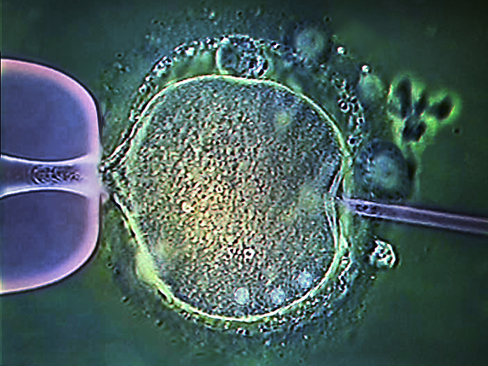 In vitro fertilisation, light micrograph Coloured light micrograph of a micro needle  right  and pipette  left  that are being used to fertilise a human egg cell  oocyte  during the process of in vitro fertilisation  IVF . The micro needle was used to inject a human sperm cell into the human egg cell. This IVF technique is known as intracytoplasmic sperm injection  ICSI . The injected sperm fertilises the egg and the resulting zygote is then grown in the laboratory until it reaches an early stage of embryonic development. It is then implanted in the patient s uterus, where it develops into a foetus. IVF allows infertile couples to conceive a child., by ZEPHYR SCIENCE PHOTO LIBRARY