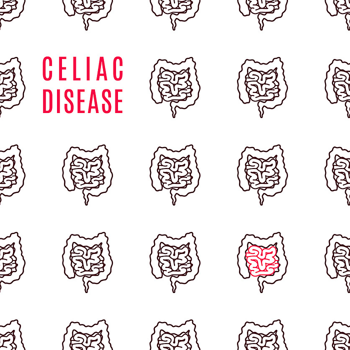 Celiac disease, conceptual illustration Celiac disease, conceptual illustration., by ART4STOCK SCIENCE PHOTO LIBRARY