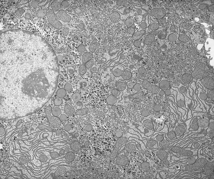 Liver, TEM Transmission electron micrograph  TEM  of the ultrastructure of a liver cell  hepatocyte . The very rich supply of cytoplasmic organelles and inclusions is indicative of the high level of metabolism and complexity of liver functions. The most abundant cytoplasmic structures seen in this region of the hepatocyte are glycogen granules, mitochondria, rough endoplasmic reticulum, peroxisomes and tubulovesicles of smooth endoplasmic reticulum. Lysosomes are also seen. Magnification: x6,500 when printed at a width of 10cm., by MICROSCAPE SCIENCE PHOTO LIBRARY