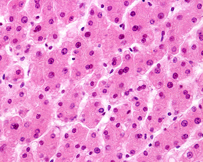 Human liver, light micrograph Light micrograph of a human liver stained with haematoxylin and eosin. Many of the hepatocytes  liver cells  have two nuclei, or a very large nucleus. These cells are polyploid cells, with 4, 8 or more times the haploid chromosome complement., by JOSE CALVO   SCIENCE PHOTO LIBRARY