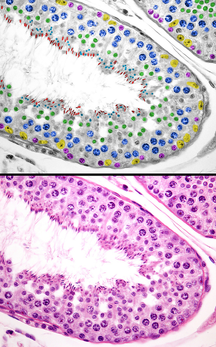 Spermatogenesis in human testicle, light micrographs Human testicle, light micrographs. The bottom micrograph shows a seminiferous tubule. In the top micrograph the cell types of the male germinal epithelium have been marked with colour. See are  Sertoli cells  yellow , spermatogonia  pink , primary spermatocytes in pachytene phase  blue , spermatids  green , spermatozoa  red  and residual bodies  light blue ., by JOSE CALVO   SCIENCE PHOTO LIBRARY