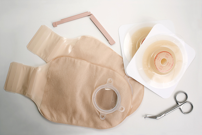 Colostomy supplies Ostomy supplies, colostomy bag, scissors and disk with scissors for colostomy., by SHERRY YATES YOUNG SCIENCE PHOTO LIBRARY