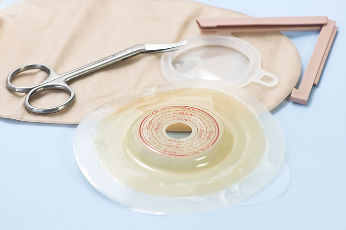 Ostomy supplies Ostomy supplies with scissors., by SHERRY YATES YOUNG SCIENCE PHOTO LIBRARY