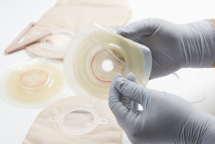 Ostomy supplies Nurse preparing ostomy supplies for use with patient., by SHERRY YATES YOUNG SCIENCE PHOTO LIBRARY