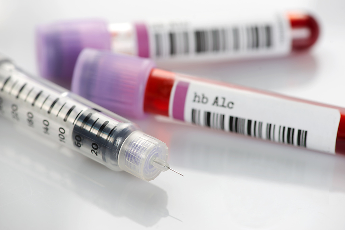 Insulin pen and hbA1c blood test tubes Insulin pen and haemoglobin A1c blood test tubes. The hbA1c test can asses glucose control and insulin regimen effectiveness in diabetic individuals., by SHERRY YATES YOUNG SCIENCE PHOTO LIBRARY