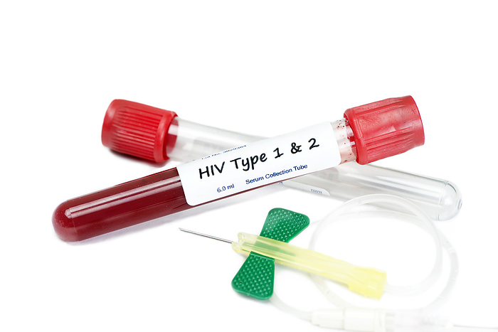 HIV test HIV type 1 and type 2 blood test collection tubes with butterfly catheter and tube holder., by SHERRY YATES YOUNG SCIENCE PHOTO LIBRARY