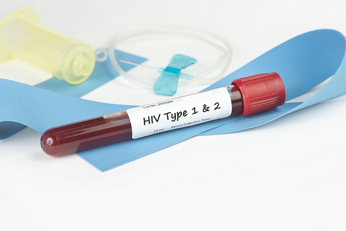 HIV type 1 and 2 HIV type 1 and 2 blood collection tube with butterfly catheter and band., by SHERRY YATES YOUNG SCIENCE PHOTO LIBRARY