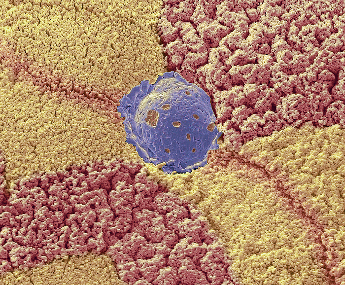 Colon, SEM Colon. Colour scanning electron micrograph  SEM  of the wall of the large intestine  colon , showing mucous secretion  blue . Goblet cells are mucous secreting cells. Large numbers micro  villi of absorptive cells are visible. The colon functions to absorb water and remaining nutrients from digested food faeces. Microvilli on absorptive cells increase the colon surface area for this purpose. The mucous secreted by goblet cells lubricates the passage of faeces, protecting the colon wall from mechanical damage  it also enables faeces to pass closely over absorptive cells to assist with absorption. Magnification: x4500 when printed 10 centimetres wide., by STEVE GSCHMEISSNER SCIENCE PHOTO LIBRARY