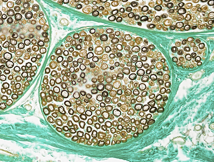Peripheral nerve, light micrograph Light micrograph of a cross section of a peripheral nerve showing myelinated axons. Myelin forms sheaths  brown or black  enclosing the central axon. As an electrical insulator myelin facilitates rapid conduction of impulses along the axon. The nerves shown are supported by connective tissue  green  called perineurium. Paraffin section, osmium fast green stain. Magnification: x 290  width printed at 10cm., by MICROSCAPE SCIENCE PHOTO LIBRARY