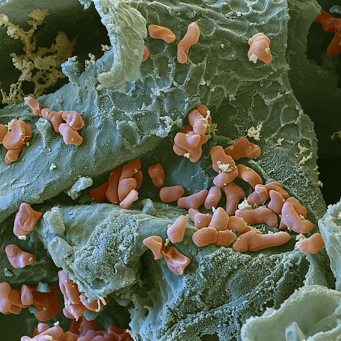 Coral berry leaf with symbiotic bacteria, SEM Coloured scanning electron micrograph  SEM  of a cross section through a coral berry, or Christmas berry,  Ardisia crenata  leaf. Within the leaf are symbiotic Phyllobacterium myrsinacearum bacteria  red.  The bacteria produce an insecticide  FR900359  that makes the plant very resistant to insect damage. FR900359 is being investigated as a potential drug and has been shown to be effective against asthma and certain types of cancer, including choroidal melanoma, in cell and mouse models. Magnification: x10000 when printed at 15 centimetres wide., by EYE OF SCIENCE SCIENCE PHOTO LIBRARY