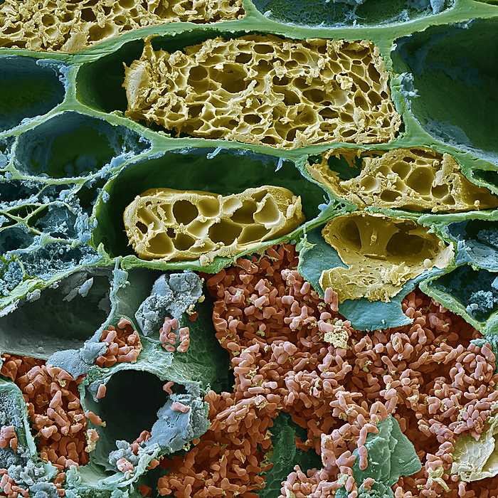 Coral berry leaf with symbiotic bacteria, SEM Coloured scanning electron micrograph  SEM  of a cross section through a coral berry, or Christmas berry,  Ardisia crenata  leaf. Within the leaf are symbiotic Phyllobacterium myrsinacearum bacteria  red.  The bacteria produce an insecticide  FR900359  that makes the plant very resistant to insect damage. FR900359 is being investigated as a potential drug and has been shown to be effective against asthma and certain types of cancer, including choroidal melanoma, in cell and mouse models. Magnification: x3000 when printed at 15 centimetres wide., by EYE OF SCIENCE SCIENCE PHOTO LIBRARY