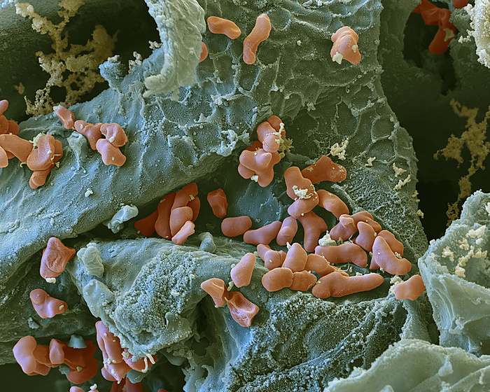 Coral berry leaf with symbiotic bacteria, SEM Coloured scanning electron micrograph  SEM  of a cross section through a coral berry, or Christmas berry,  Ardisia crenata  leaf. Within the leaf are symbiotic Phyllobacterium myrsinacearum bacteria  red.  The bacteria produce an insecticide  FR900359  that makes the plant very resistant to insect damage. FR900359 is being investigated as a potential drug and has been shown to be effective against asthma and certain types of cancer, including choroidal melanoma, in cell and mouse models. Magnification: x8000 when printed at 15 centimetres wide., by EYE OF SCIENCE SCIENCE PHOTO LIBRARY