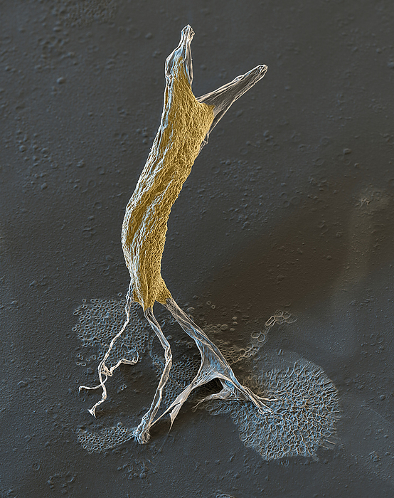 Amoeba fruiting body, SEM Coloured scanning electron micrograph  SEM  of a fruiting body of a Dictyostelium discoideum social amoeba, or slime mould. Under favourable conditions, D. discoideum lives as a unicellular organism in the soil. When there is a lack of nutrients, the unicellular amoeba form a multicellular aggregation known as a slug. The cells within the slug differentiate, with some forming a fruiting body, or sorocarp, on a long stalk, which releases spores when mature. D. discoideum is being researched for use as a unicellular  factory  to produce a number of molecules including antibiotics and olivetolic acid, a precursor of tetrahydrocannabinol  THC , the psychoactive substance in cannabis. Magnification: x250 when printed at 15 centimetres wide., by EYE OF SCIENCE SCIENCE PHOTO LIBRARY