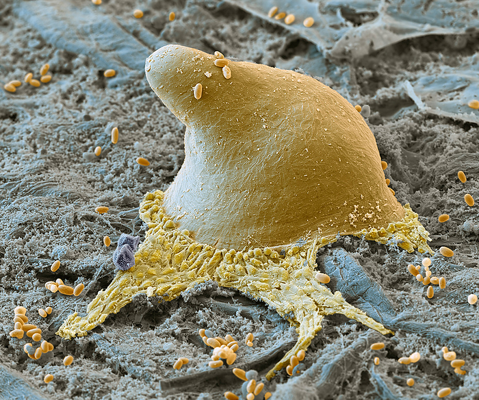 Amoeba fruiting body, SEM Coloured scanning electron micrograph  SEM  of a forming fruiting body of a Dictyostelium discoideum social amoeba, or slime mould. Some single amoeba  yellow  as well as spores from other fruiting bodies are seen. Under favourable conditions, D. discoideum lives as a unicellular organism in the soil. When there is a lack of nutrients, the unicellular amoeba form a multicellular aggregation known as a slug. The cells within the slug differentiate, with some forming a fruiting body, or sorocarp, on a long stalk, which releases spores when mature. D. discoideum is being researched for use as a unicellular  factory  to produce a number of molecules including antibiotics and olivetolic acid, a precursor of tetrahydrocannabinol  THC , the psychoactive substance in cannabis. Magnification: x800 when printed at 15 centimetres wide., by EYE OF SCIENCE SCIENCE PHOTO LIBRARY