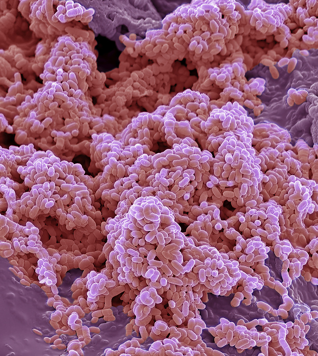 Lip microbiome, SEM Lip microbiome. Coloured scanning electron micrograph  SEM  of bacteria cultured from a lip. When kissing on the lips or cheeks bacteria are exchanged from one person to another. Among humans, approximately 90  of cultures have some type of kissing. Usually it is platonic, such as a parent kissing a child. However, in 46  of all cultures, it can go as far as intimate kissing. A recent scientific study has revealed that on average 80 million bacteria are transferred to the partner during a kiss of 10 seconds. Most partners share a more similar oral microbiome compared to unrelated individuals. Some of the collective bacteria among partners are only transiently present, while others have found a true niche and survive permanently, allowing long term colonization. Magnification: x1000 when printed at 10cm wide., by STEVE GSCHMEISSNER SCIENCE PHOTO LIBRARY