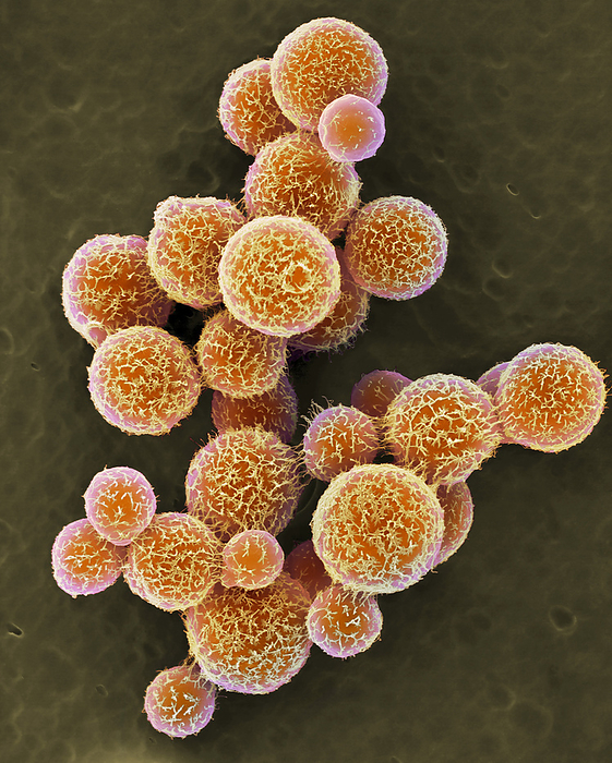 Cryptococcus neoformans yeast, SEM Coloured scanning electron micrograph  SEM  of a group of Cryptococcus neoformans. A yeast like fungus that reproduces by budding. An acidic mucopolysaccharide capsule completely encloses the fungus. It can cause the disease cryptococcosis, especially in immune deficient humans, such as in patients with HIV AIDS. The most common clinical form is meningoencephalitis. It is caused by inhaling the fungus found in soil that has been contaminated by pigeon droppings. Magnification: x1, 000 when shortest axis printed at 25 millimetres., by DENNIS KUNKEL MICROSCOPY SCIENCE PHOTO LIBRARY