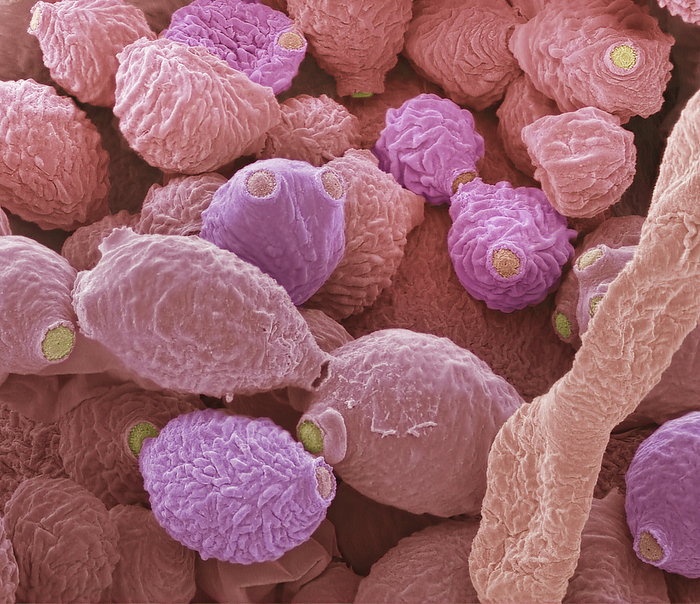 Oral fungi, SEM Oral fungi. Coloured scanning electron micrograph  SEM  of a culture from a used toothpick. The oral microbial community is one of the most diverse in the human body, The human oral cavity hosts a complex microbiota comprised of an estimated 600 bacterial species and 100 fungal species. In a study of fungal species Candida and Aspergillus are the most frequently observed genera  isolated from 100  of participants , followed by Penicillium  97  , Schizophyllum  93  , Rhodotorula  90  , and Gibberella  83  . Both mutualistic and pathogenic microbes reside in the mouth. Pathogens often exist on pellicile, coating the dental tissues  enamel, dentin, cementum  and forming a complex matrix, or biofilm, more commonly known as dental plaque. These pathogens primarily affect the teeth, causing dental caries, also known as tooth decay. Magnification: x4000 when printed 10 centimetres wide., by STEVE GSCHMEISSNER SCIENCE PHOTO LIBRARY