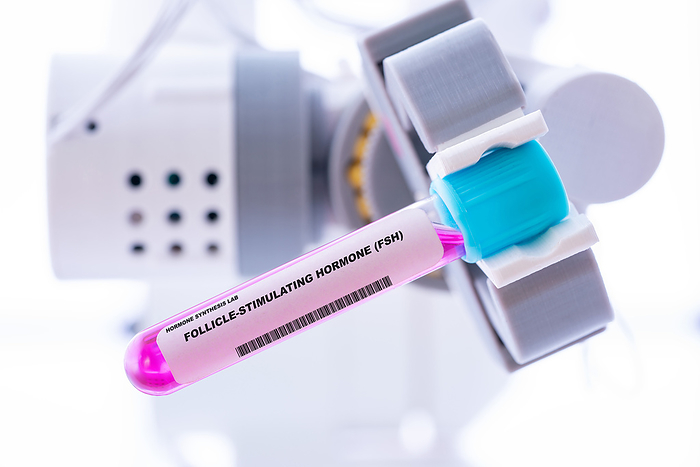 Follicle stimulating hormone  FSH , conceptual image Conceptual image of a test tube of follicle stimulating hormone  FSH  held by a robotic arm. , by WLADIMIR BULGAR SCIENCE PHOTO LIBRARY
