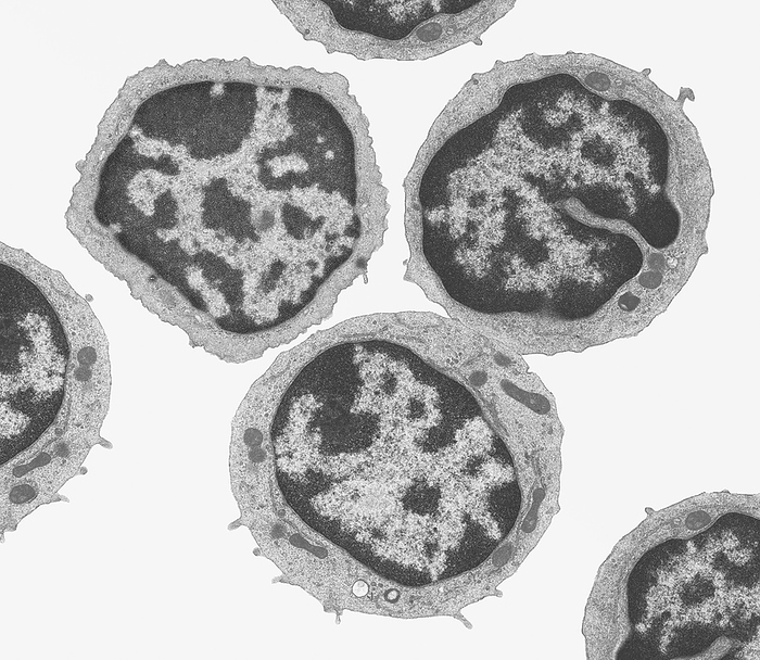 Small lymphocytes, TEM Small lymphocytes. Black and white transmission electron micrograph  TEM  of a section of small lymphocytes. Lymphocytes are involved in the immune system s defence mechanisms, lymph system, and antibody production. These cells arise from large lymphocytes and will migrate to blood vessels and circulate around the body. These are the most common type of white cell in normal blood. They have a large, dense, round nucleus and thin basophilic cytoplasm. Magnification: x4000 when printed 10 centimetres wide., by STEVE GSCHMEISSNER SCIENCE PHOTO LIBRARY