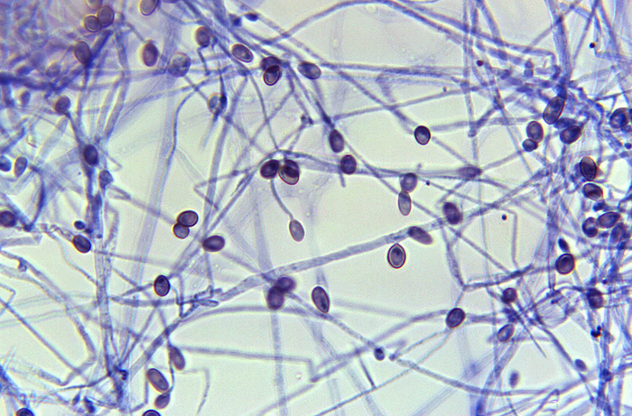 Pseudallescheria boydii, light micrograph Light micrograph showing conidia attached to the hypha of the fungus Pseudallescheria boydii., by CDC Dr. Hardin SCIENCE PHOTO LIBRARY