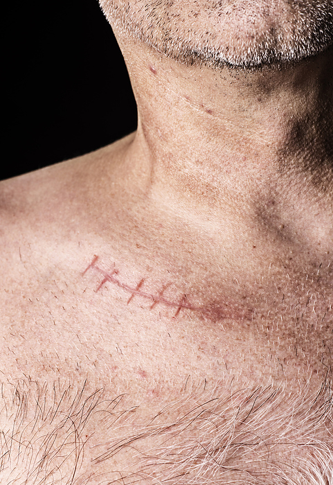 Upper body of man with scar