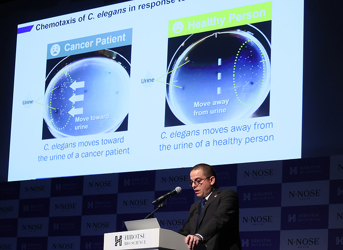 Presentation of  N NOSE plus pancreatic  early stage pancreatic cancer test November 17, 2022, Tokyo, Japan   Eric di Luccio, CTO of Hirotsu Bioscience announces the company develops the pancreatic cancer screening test  N Nose plus Pancreas  using user s urine in Tokyo on Thursday, November 17, 2022. Hirotsu Bioscience developed the new cancer specific test using genetically modifying C. elegans nematodes which react to smell of urine of patients of pancreatic cancer.     Photo by Yoshio Tsunoda AFLO  
