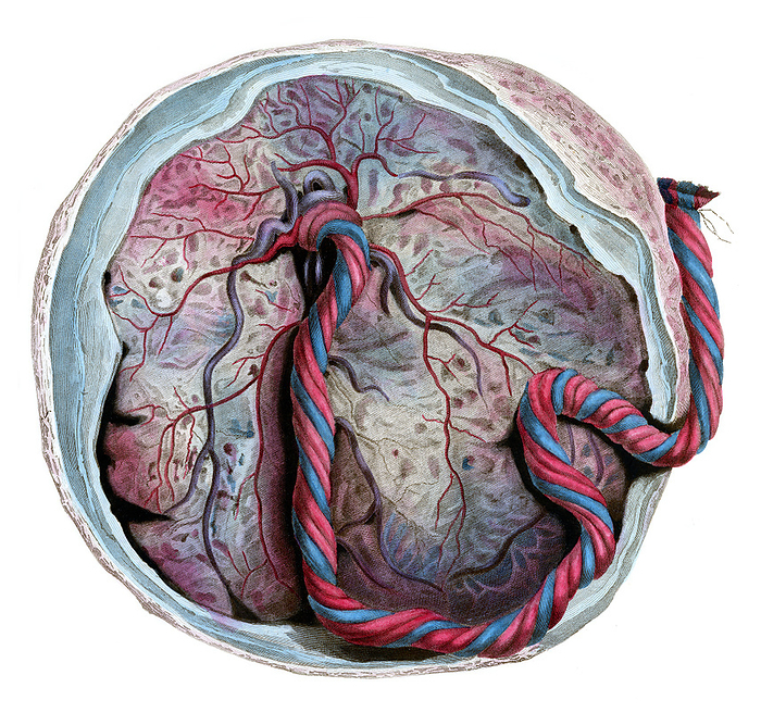 Human placenta, illustration Human placenta, illustration. This is the fetal side of the placenta. The cut membranes are the amnion, chorion and the decidua  of the uterus . The amnion covering the umbilicus has been removed, showing the umbilical vein  blue  and the two umbilical arteries  red . Large chorionic vessels on the placenta surface converge to the umbilical cord. Compartments of the placental tissue are called cotyledons. At birth the placenta is 15 25 cm in diameter, 3 cm thick, and weighs about 500 g. From Lizars, J. 1823 A system of anatomical plates of the human body. W. H.Lizars, Edinburgh., by MICROSCAPE SCIENCE PHOTO LIBRARY