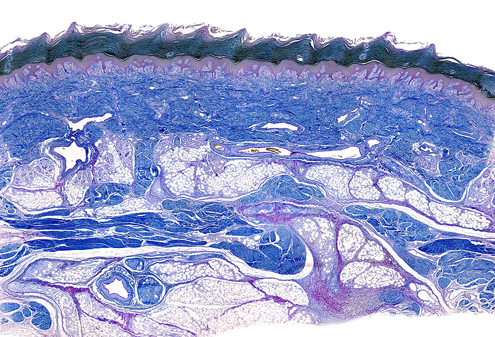 Sole of the foot, light micrograph Light micrograph of human thick skin stained with the Cajal Gallego method showing, from top: the epidermis with a thick stratum corneum or horny layer, the dermis, with abundant collagen fibres stained blue, and the hypodermis or subcutaneous tissue, with adipose  fat  tissue lobules separated by thick connective tissue sheets rich in collagen fibres., by JOSE CALVO   SCIENCE PHOTO LIBRARY